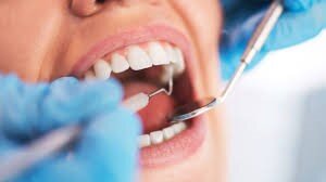 دندانپزشکی - با بیمه دندانپزشکی، هزینه گزاف دندان پزشکی را در 1400 به صفر برسانید