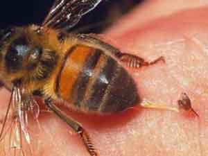 زنبور عسل 300x225 - زهر زنبور عسل نوع تهاجمی سرطان پستان را در ۶۰ دقیقه از بین می‌برد