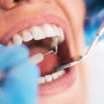 150x150 - با بیمه دندانپزشکی، هزینه گزاف دندان پزشکی را در 1400 به صفر برسانید